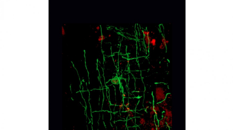 D'anciens virus ont joué un rôle dans le développement avancé de nos cerveaux